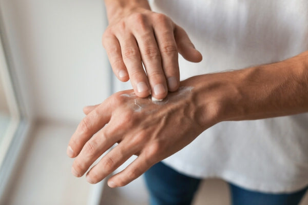 How to use topical magnesium man applying magnesium cream to his hand
