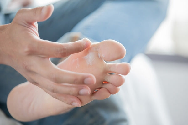 how to help skin changes from chronic nerve pain close up of person rubbing cream onto their foot