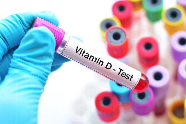 Vitamin D for Immune System Blood Test Sample Vial