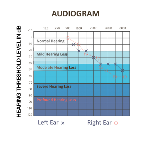 Audiogram illustrating hearing loss and risk threshold