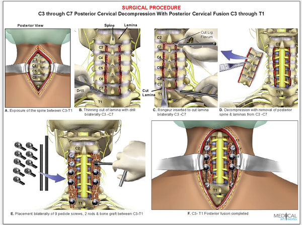 cpt code for cervical spine x ray