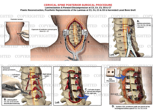 neck decompressor