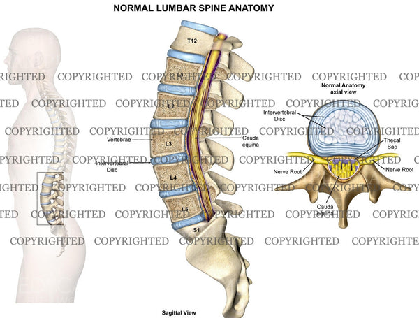 Lumbar Spine X Ray Anatomy 0584