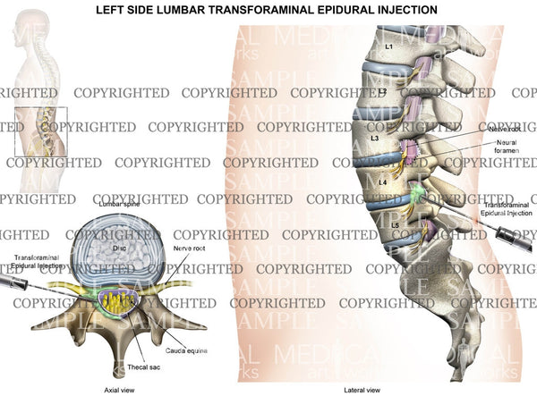 l4 lumbar