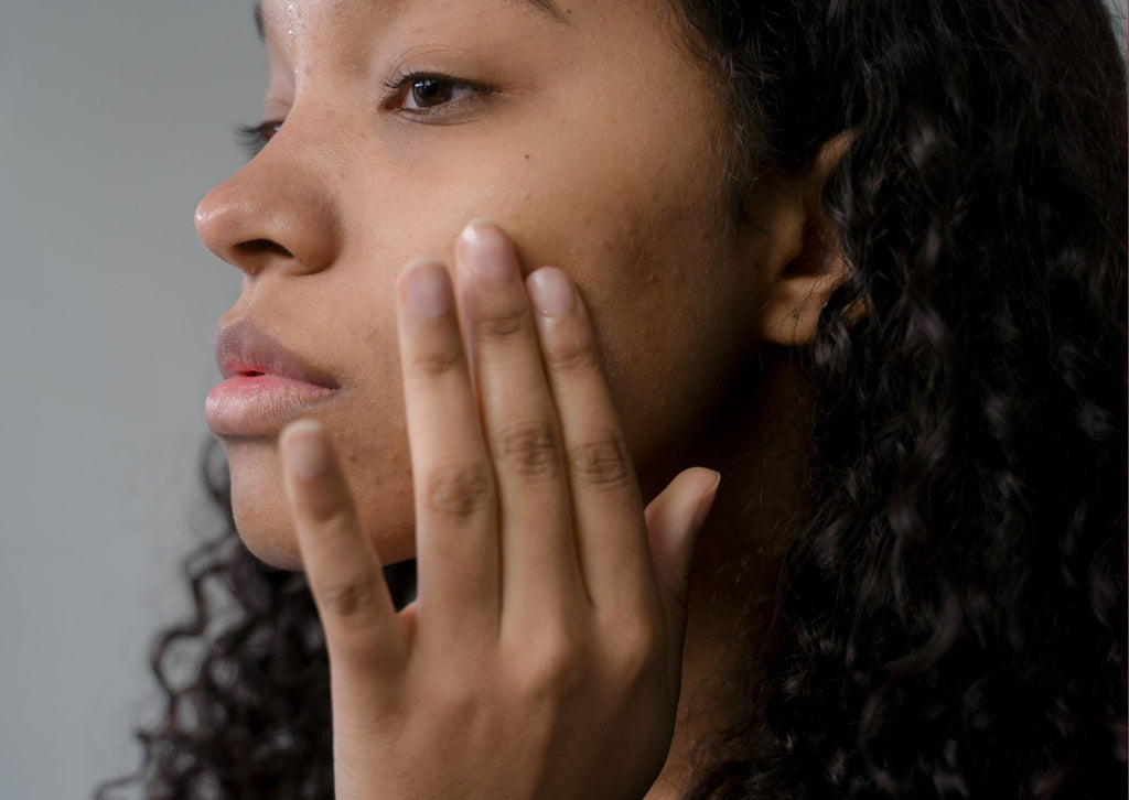 Absolème comment se débarrasser des points noirs ?