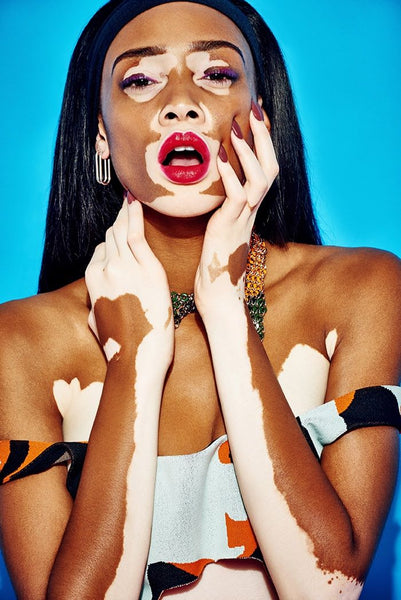 Absolème mode inclusive mannequins atypiques Winnie Harlow