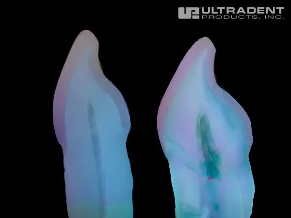 Ultradent Mosaic omposite fluorescence mimics natural dentin and enamel