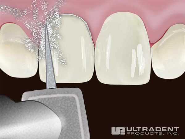 Trim access composite from periphery