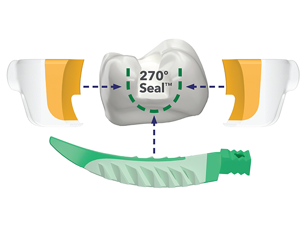 270 Degree matrix seal