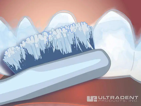 When the appropriate amount of time has elapsed, remove tray and use a clean finger or soft toothbrush to clean excess gel from teeth. Opalescence PF Step 3