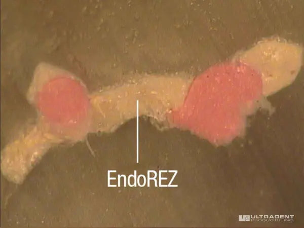 EndoREZ Sequece-Test