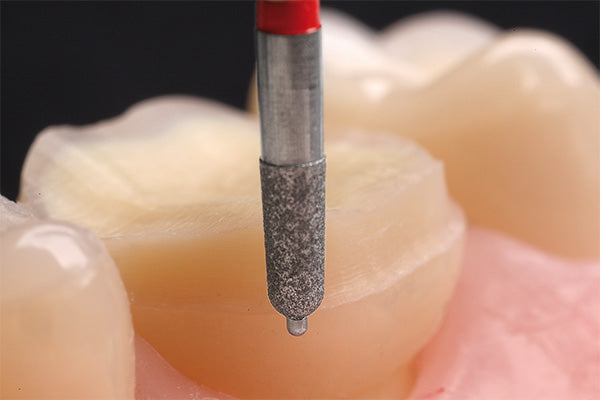 Komet 8849P Crown Preparation Diamond Bur in use