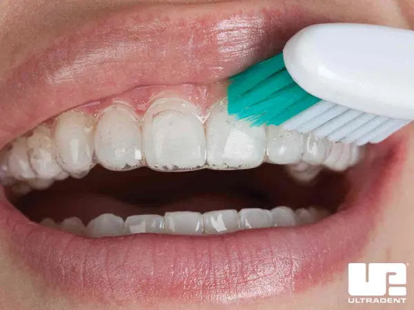 Remove excess gel with a soft toothbrush