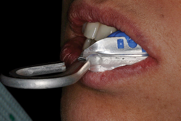 Affinity Clinical Technique Tray Bite