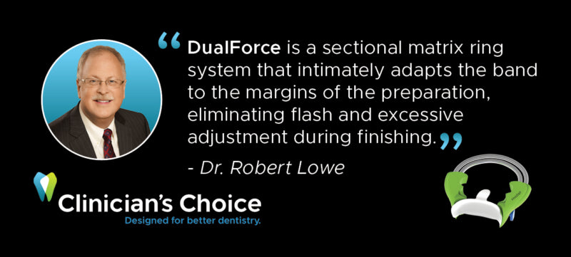 DualForce is a sectional matrix ring system that intimately adapts the band to the margin of the preparation, eliminating flash and excessive adjustment during finishing. Dr. Robert Lowe