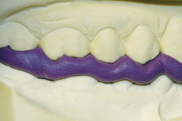 Modèle dérivé Counter-Fit Ajustement idéal pour l'enregistrement de l'occlusion