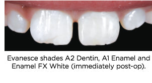 Emergency Class IV Case After