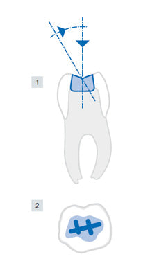 H32 clinical technique