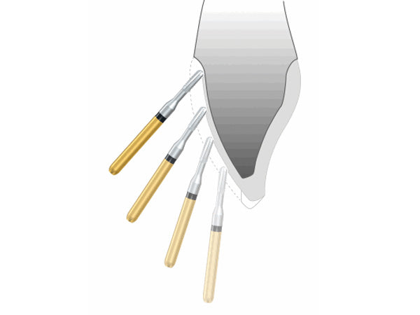 an illustration showing the right angle when using H35L to remove crown