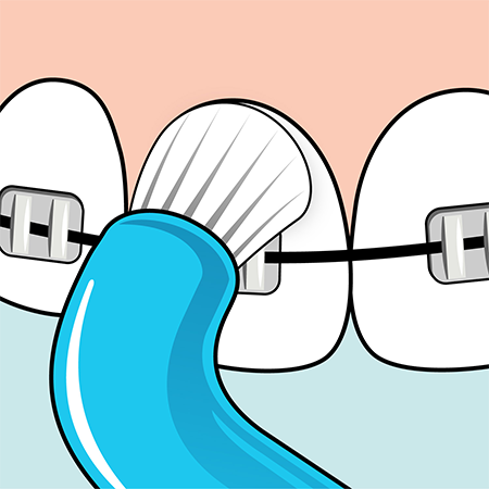 Toothbrush for braces