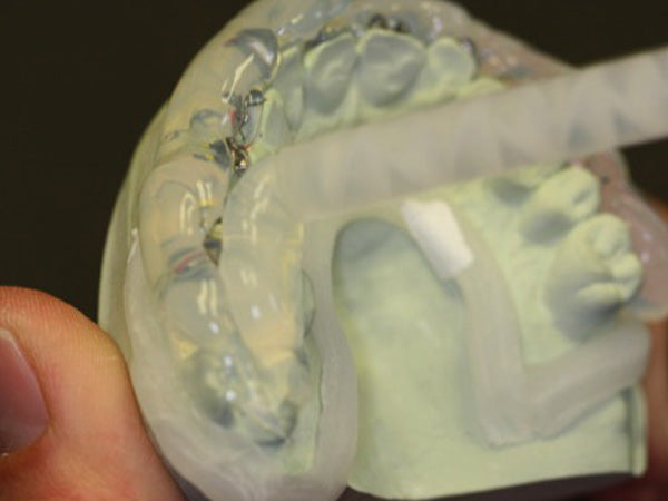 After placing brackets on a model and light-curing them for 3 seconds, place Affinity Crystal clear impression material on labial, buccal, occlusal and palatal surfaces.