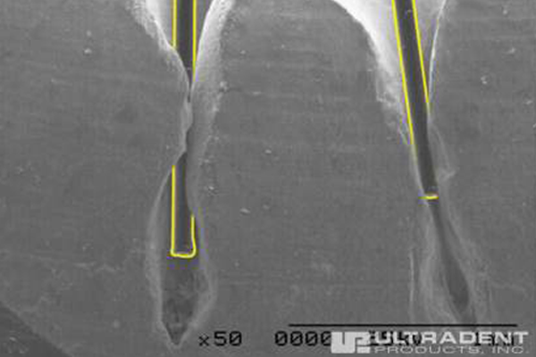 Tiny Fibres for Direct Delivery