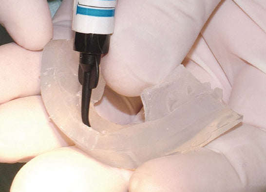 Affinity Crystal Clinical Technique 5: Syringe a thixotropic flowable material directly into the facial/internal aspect of the clear matrix. Start at the incisal edge, working toward the cervical.