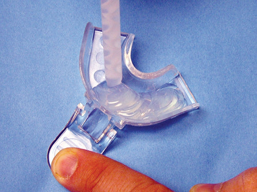 Affinity Crystal Clinical Technique 2: Fill a clear, non-perforated tray with Affinity Crystal.