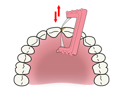 ContacEZ Hygiéniste Bande Rose Technique Clinique 2