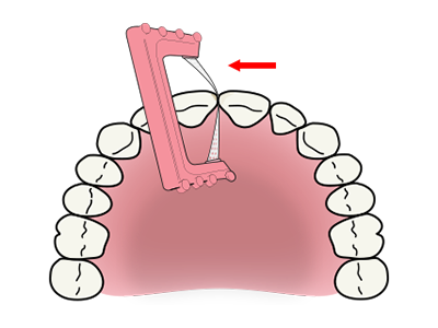 ContacEZ Hygienist Pink Strip Clinical Technique 3