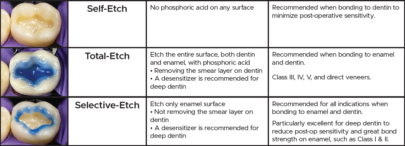 mpa universal placement chart