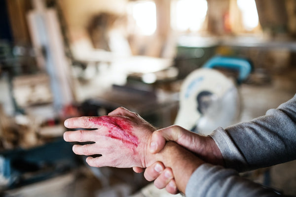 man experiencing types of bleeding from his hand