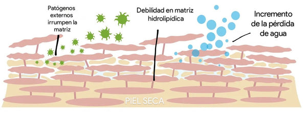 Piel seca infografía