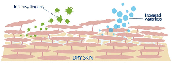 efectos deshidratación picor en piel del cuerpo