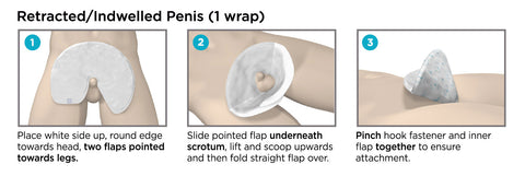 QuickChange Retracted or Indwelling Penis Application Instructions