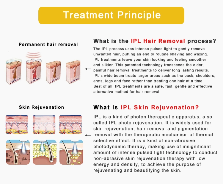 IPL SHR E-light hair removal machine
