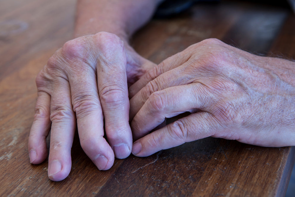Psoriatic Arthritis in Hands