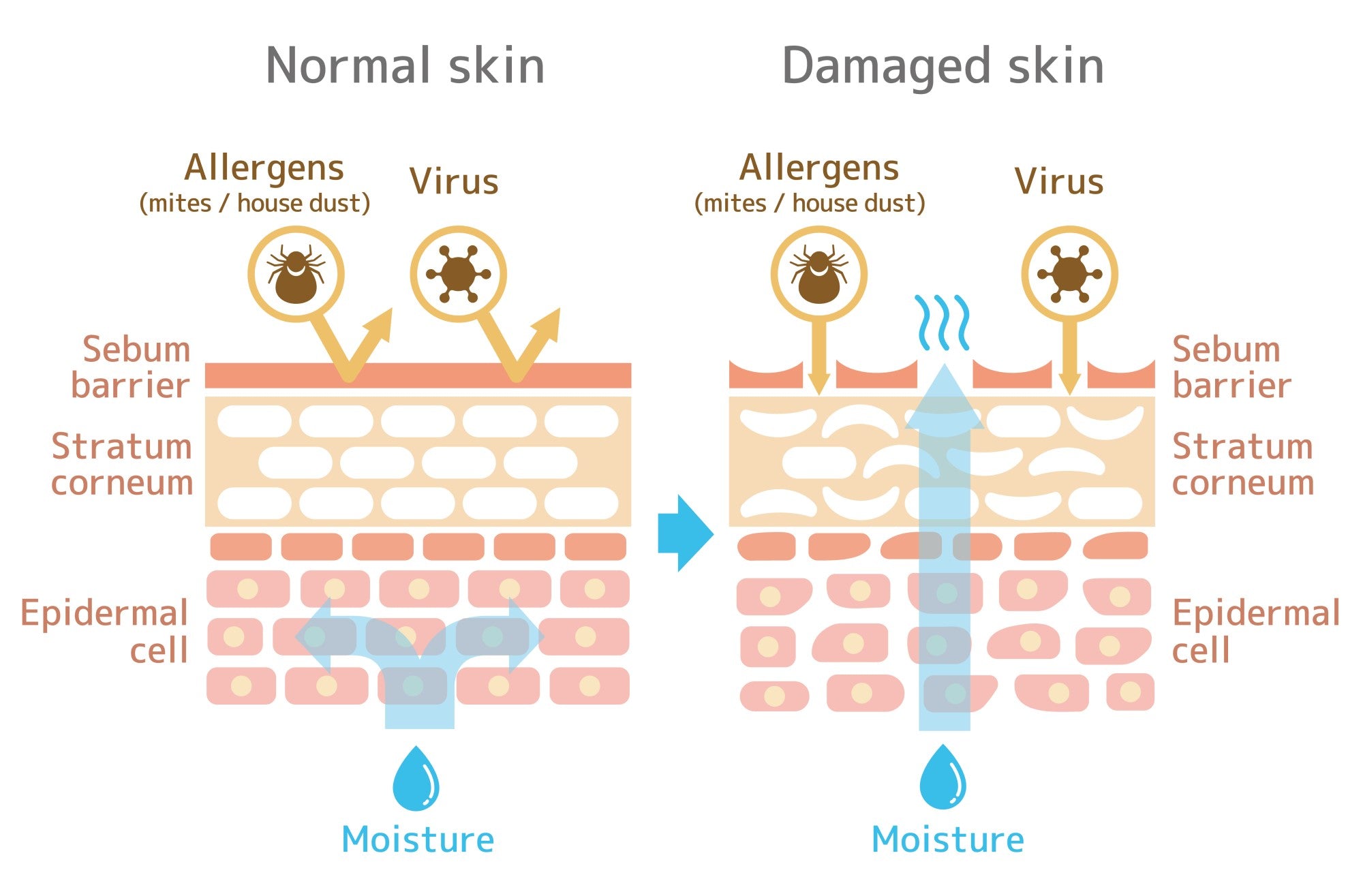 Healthy Skin Barrier Lipids Ceramides