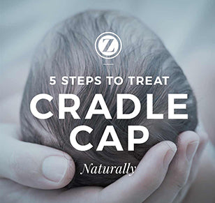 5 Steps to Treating Cradle Cap Naturally