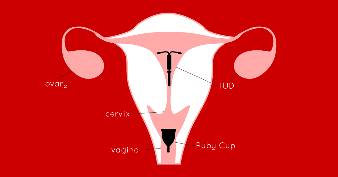 Can You Use a Menstrual Cup an Our Expert Guide | Ruby Ruby Cup