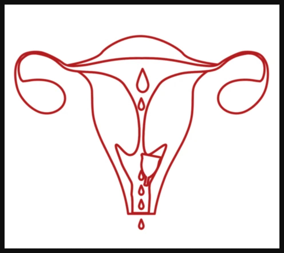 Ruby Cup image of a menstrual cup sitting in the vaginal fornix.