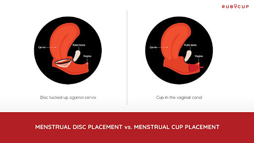 Menstrual disc and menstrual cup placements inside the vagina