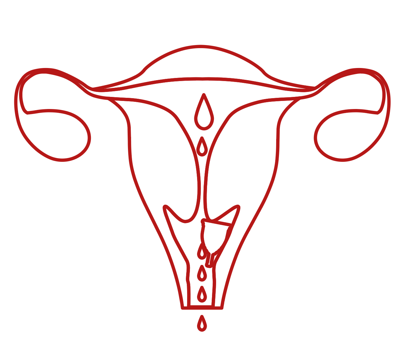 Menstrual cup wrong placement