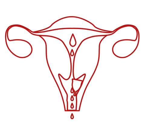 Menstrual cup placement