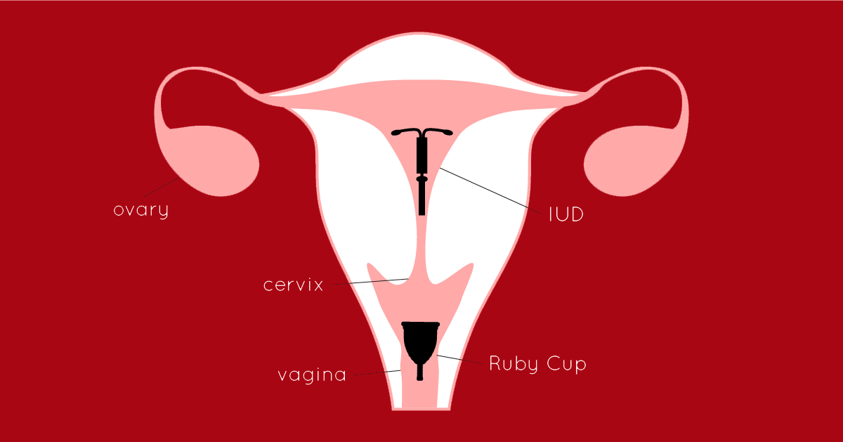 Diagram showing where both the IUD and your menstrual cup sit