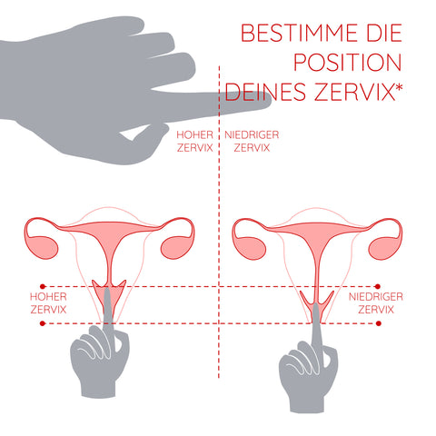 Position Zervix Bestimmen