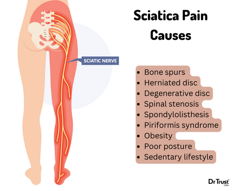 Sciatica pain 