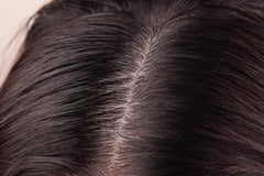 Scalp image with dark hair