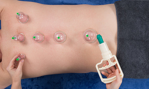 12-Cup Biomagnetic Chinese Cupping Therapy Set