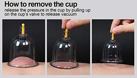Plastic Vacuum Cupping Massage Kit,Magnetic Treatments with Pumping Handle